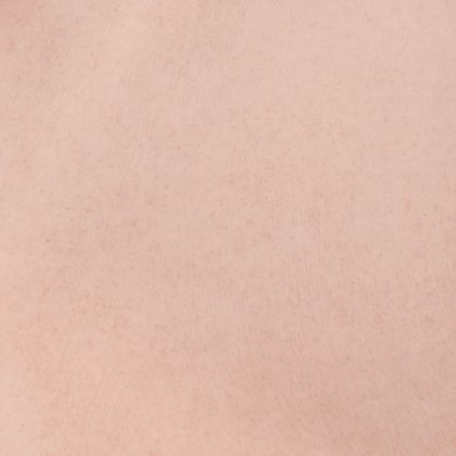 Силиконов нагръдник, кавказки, C чашка